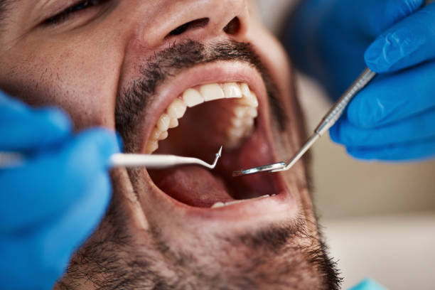 Best Pediatric Emergency Dentist in Meadowbrook, VA